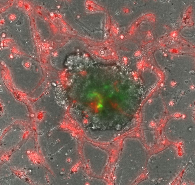 News item Bring in the Lymph