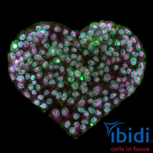 Technology Seminar: ibidi–Cells in Focus